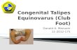 Congenital Talipes Equinovalrus (Club Foot)
