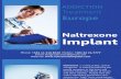 Naltrexone Implant Treatment and Side Effects