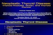 Neoplastic Thyroid Disease.thyroid Nodules Goiter and Thyroid Cancer