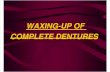 Waxing-up of Complete Dentures