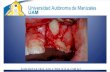Abordajes en Cirugia Dento Alveolar