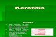 Keratitis 09