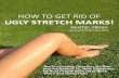 How To Get Rid Of Ugly Stretch Marks PDF, eBook by Heather Allison