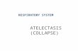 Atelectasis (collapse)