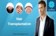Hair Transplantation Surgery in Kerala | Hair Restoration Treatment in India