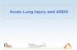 Acute Lung Injury and ARDS