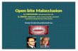 Open bite-malocclusions-dr m-aboualnaser-dr-o-sandid