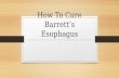 How to cure barrett’s esophagus | Natural Remedies to Cure Barrett's Esophagus