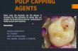Pulp capping agents