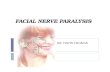 Facial nerve paralysis  dr.davis -11.04.16