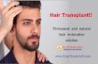 Hair Transplant in Bangalore | Best Hair Loss Treatment in India