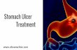 Stomach Ulcer Treatment | Gastroenterologist in Chennai