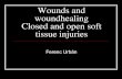 Wounds and woundhealing Closed and open soft tissue injuries