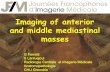 G ferretti  anterior and middle mediastinal mass jfim hanoi 2015