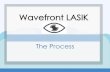 Wavefront LASIK: The Process