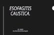 Esofagitis caustica