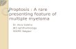 Proptosis : A Rare Presenting Feature Of Multiple Myeloma.