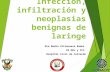 Infección, infiltración y neoplasias benignas de laringe
