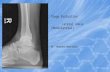 Image evaluation  lateral ankle mattingly