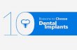 Dental Implants London : Why Do You Need Tooth Implants