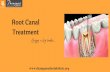 Root Canal Treatment In Chennai | Dental Treatments In India