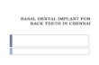 Basal dental implant for back teeth in chennai