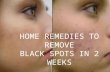 home remedies to remove dark spots in 2 weeks