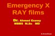 Emergency x ray films Dr Ahmed Esawy