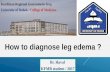 How to diagnose leg edema ?