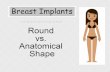 Breast Implants: Round vs. Anatomical Shape