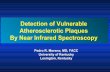 Detection of vulnerable plaque by nis