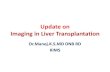 Imaging in Liver Transplant