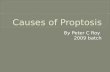 Causes of proptosis