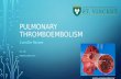 Pulmonary thromboembolism new
