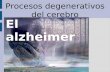 Presentacion Alzheimer