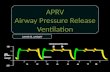 Airway releasing ventilation