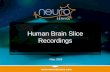 Human brain slices recordings