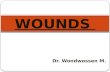 Wound for c i