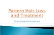 Pattern hair loss and treatment