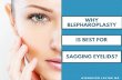 Why blepharoplasty is best for sagging eyelids?