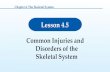 Lesson 4.5 Common Injuries and Disorders of the Skeletal System Chapter 4: The Skeletal System.