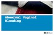 Abnormal Vaginal Bleeding. VETERANS HEALTH ADMINISTRATION Objectives 2.