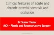 Peripheral vascular disease and Clinical features of acute and chronic arterial stenosis and occlusion