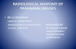 Ct  anatomy of paranasal sinus