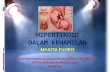 HIPERTIROID DALAM KEHAMILAN - Universitas …med.unhas.ac.id/obgin/.../2016/08/5.-hipertiroid-dalam-kehamilan-.pdf · hiperemesis gravidarum , kehamilan kembar dan mola hidatidosa