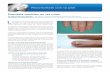 Psoriasis también en las uñas - aepso.org · PDF filea psoriasis es una enfermedad crónica que se caracteriza por afectar a la piel formando placas descamativas y en-rojecidas.