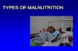 TYPES OF MALNUTRITION - fao.org.pk · PDF filemarasmus and kwashiorkor Kwashiorkor nutritional bilateral oedema. Marasmus severe loss of body weight or wasting. Food & Nutrition Training