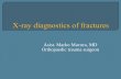 Asist. Marko Macura, MD Orthopaedic trauma  · PDF fileAbnormaly wide joint spaces may speak for ligament injuriy or impression fracture ... Surgical emergency