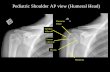 Pediatric Shoulder AP view (Humeral Head) · PDF fileHumerus. Lesser tubercle. Greater tubercle. Humerus Head. Physis. Pediatric Shoulder AP view (Humeral Head)