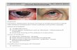 2013-2014 Clinical Ophthalmology By : Saif S. Zaina · PDF filePseudo-membrane: most of bacterial ... Is it a concomitant or incomitant squint? ... Esotropia: convergent Exotropia: